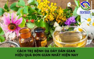 Cách trị bệnh dạ dày dân gian hiệu quả đơn giản nhất hiện nay