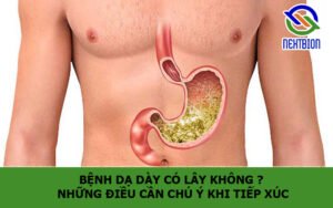 Bệnh dạ dày có lây không ? Những điều cần chú ý khi tiếp xúc