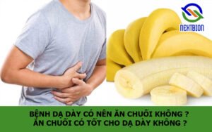 Bệnh dạ dày có nên ăn chuối không ? Ăn chuối có tốt cho dạ dày không ?