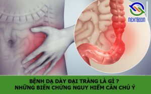 Bệnh dạ dày đại tràng là gì ? Những biến chứng nguy hiểm cần chú ý