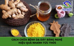 Cách chữa bệnh dạ dày bằng nghệ hiệu quả nhanh tức thời