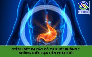 Viêm loét dạ dày có tự khỏi không ? Những điều bạn cần phải biết