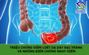 Triệu chứng viêm loét dạ dày đại tràng và những biến chứng nguy hiểm